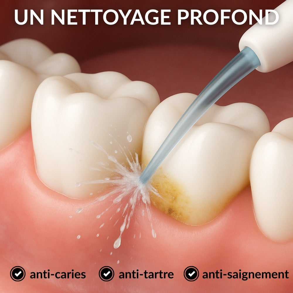 Hydropulseur haute pression - anti plaque dentaire